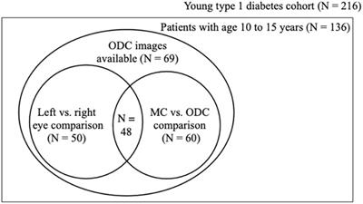 The impact of the image conversion factor and image centration on retinal vessel geometric characteristics